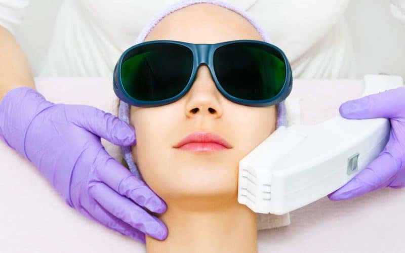 Fractional Laser Resurfacing