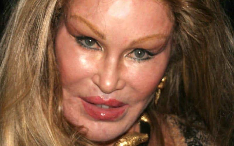 6 Celebrity Cosmetic Surgery Epic Fails – And How to Prevent Them