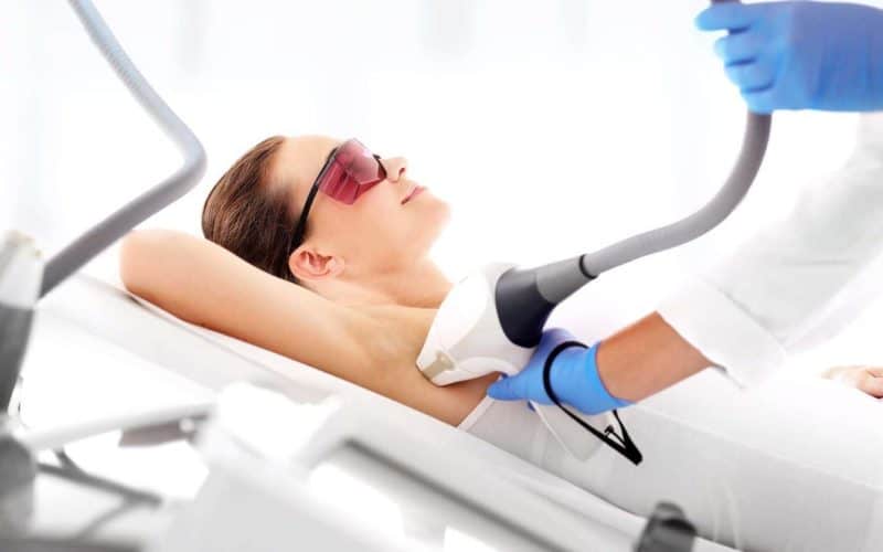 Laser Hair Removal