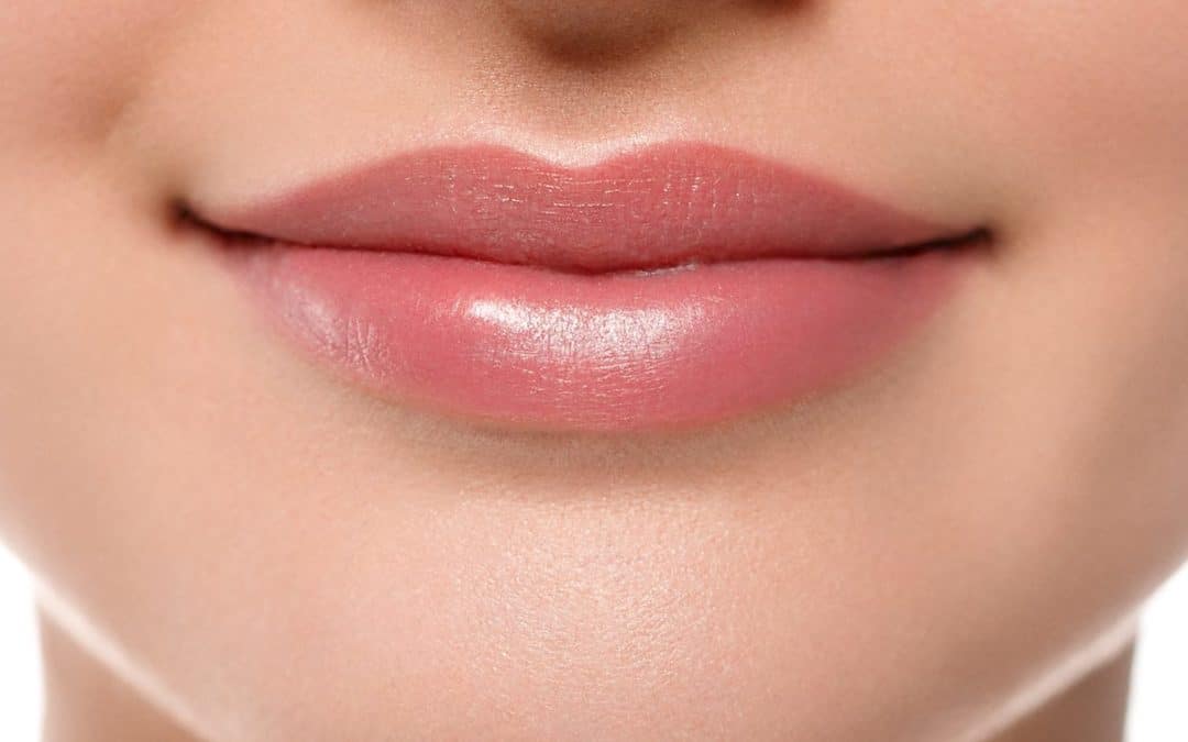 Lip Lift