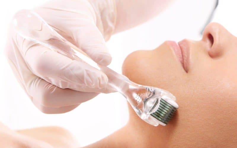 Costhetics Myth Busting Skin Needling