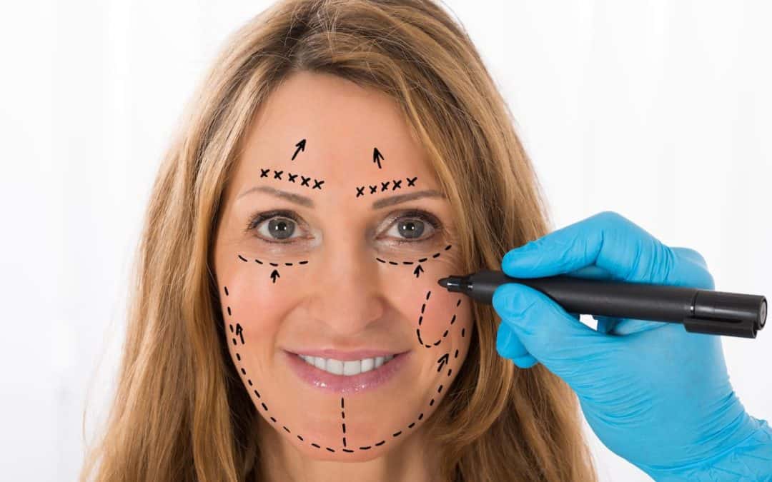 Thread Lift Vs Facelift – Which is Better for You?