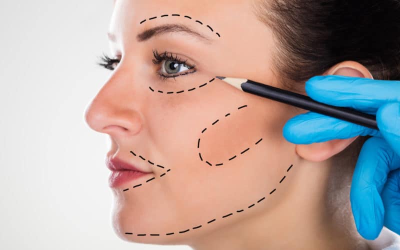 6 Facelift Myths that Won’t Die