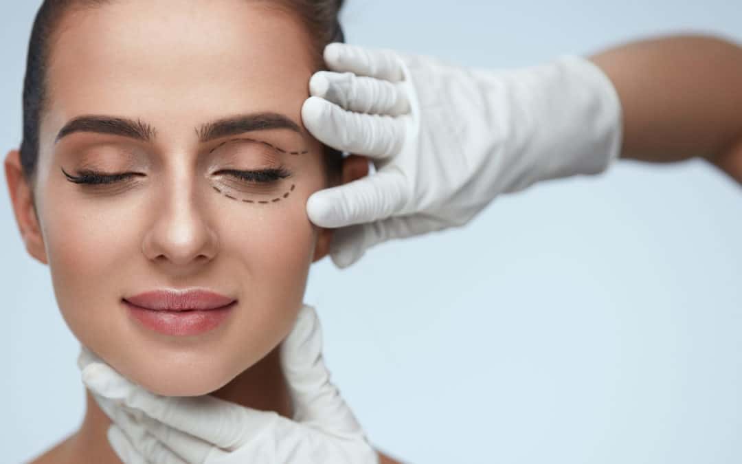 7 Things to Consider Before Eyelid Surgery