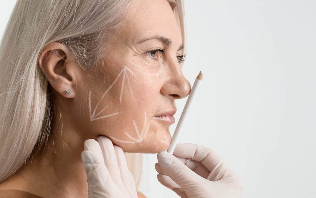 Which Facelift is Right for You?