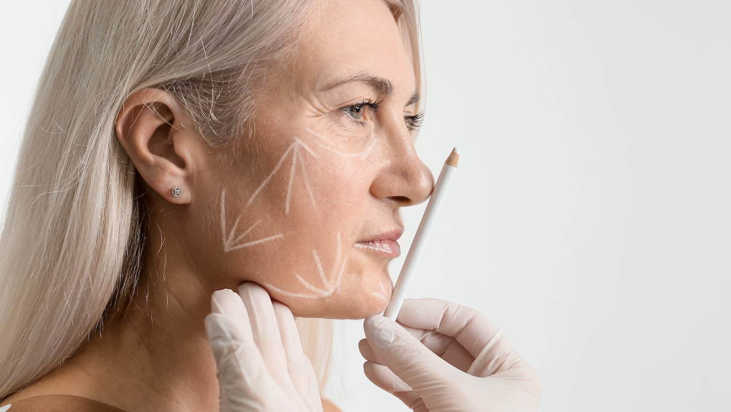 Which Facelift is Right for You? - types of face lifts